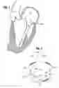 Fig. 02 - Mitral annuloplasty ring with suture line