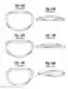 Fig. 07 - Mitral annuloplasty ring with suture line