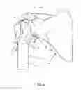 Fig. 02 - Methods, Devices and Techniques for Improved Placement and Fixation of Shoulder Implant Components