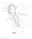 Fig. 06 - Methods, Devices and Techniques for Improved Placement and Fixation of Shoulder Implant Components