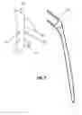 Fig. 08 - Methods, Devices and Techniques for Improved Placement and Fixation of Shoulder Implant Components