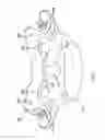 Fig. 08 - Multiple facet joint replacement