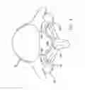 Fig. 09 - Multiple facet joint replacement