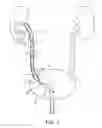 Fig. 08 - Telescoping ureteral stent