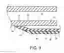 Fig. 10 - Telescoping ureteral stent