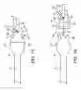 Fig. 13 - Telescoping ureteral stent