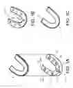 Fig. 02 - Oral motion preservation device