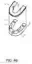Fig. 07 - Oral motion preservation device