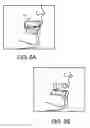 Fig. 09 - Oral motion preservation device