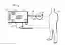 Fig. 01 - Heat exchange system for patient temperature control with multiple coolant chambers for multiple heat exchange modalities