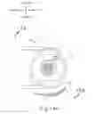 Fig. 22 - Method and apparatus for subretinal administration of therapeutic agent