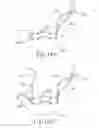 Fig. 40 - Method and apparatus for subretinal administration of therapeutic agent