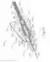 Fig. 71 - Method and apparatus for subretinal administration of therapeutic agent