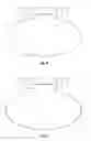 Fig. 06 - Ophthalmic surgical device for capsulotomy