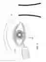Fig. 08 - Methods and apparatus for delivering ocular implants into the eye
