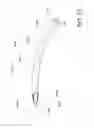 Fig. 22 - Methods and apparatus for delivering ocular implants into the eye