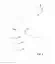 Fig. 04 - Methods and apparatus for delivering ocular implants into the eye