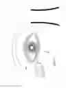 Fig. 08 - Methods and apparatus for delivering ocular implants into the eye