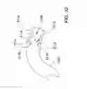 Fig. 33 - Methods and apparatus for delivering ocular implants into the eye