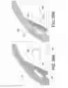 Fig. 37 - Methods and apparatus for delivering ocular implants into the eye