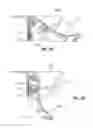 Fig. 80 - Hospital bed