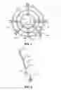 Fig. 02 - Therapeutic mobility assistive device