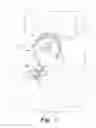 Fig. 02 - MICRO-BOLUS FEEDER KIT FOR INFANTS