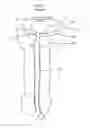 Fig. 02 - Stretch valve balloon catheter and methods for producing and using same