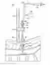Fig. 01 - SPINAL CORD PULSATION-CANCELATION INJECTION SYSTEM