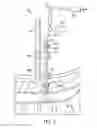 Fig. 04 - SPINAL CORD PULSATION-CANCELATION INJECTION SYSTEM