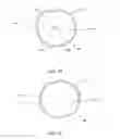 Fig. 03 - Cap with clasp permanently attached