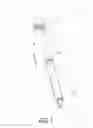 Fig. 02 - Bicycle seatpost assembly