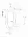 Fig. 06 - METHODS AND APPARATUSES FOR MOVING OBJECTS BASED ON A BUOYANCY FORCE