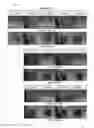 Fig. 02 - METHOD FOR DETACHING CELLS FROM ADHESION SURFACE AND CELL DETACHMENT SYSTEM