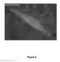 Fig. 09 - Antisense polynucleotides to induce exon skipping and methods of treating dystrophies