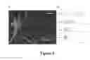 Fig. 09 - VECTORS FOR DELIVERY OF LIGHT SENSITIVE PROTEINS AND METHODS OF USE