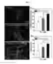Fig. 13 - Surface modified polymeric nanofiber substrates by plasma treatment and fabrication process for the same