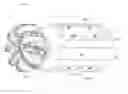 Fig. 01 - Near-Bit Borehole Opener Tool and Method of Reaming