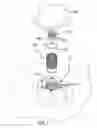 Fig. 05 - Shearable drive coupling assembly