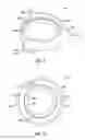 Fig. 09 - METHODS OF MANUFACTURING A FLUID DISTRIBUTION SYSTEM ASSEMBLY
