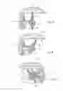 Fig. 07 - Method and device for highly-precise measurement of surfaces