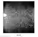 Fig. 07 - Systems for inspection of protein particles in a liquid beneficial agent