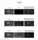Fig. 06 - MULTIPLEXED METHOD FOR DIAGNOSING CLASSICAL HODGKIN LYMPHOMA
