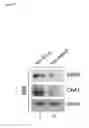 Fig. 09 - NRIP AS A BIOMARKER OF ABNORMAL FUNCTION OF MOTOR NEURONS
