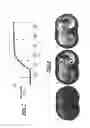 Fig. 06 - AUTOMATIC BOLUS DETECTION