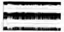 Fig. 01 - SONAR TECHNIQUE
