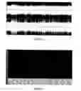 Fig. 02 - SONAR TECHNIQUE