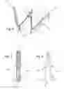 Fig. 06 - Foldable spectacles