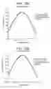 Fig. 13 - Presbyopia lens with pupil size correction based on level of refractive error
