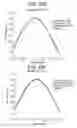 Fig. 15 - Presbyopia lens with pupil size correction based on level of refractive error